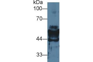 Detection of CK14 in Mouse Stomach lysate using Polyclonal Antibody to Cytokeratin 14 (CK14)