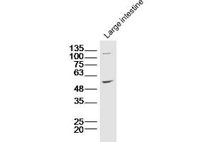 Lane 1: Mouse intestine lysates probed with ZnT-1 Polyclonal Antibody, Unconjugated  at 1:300 overnight at 4˚C. (SLC30A1 anticorps  (AA 131-330))