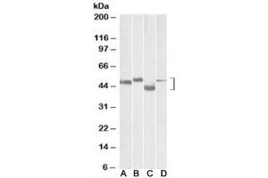 Western blot testing of mouse brain (lane A), rat brain (lane B), mouse thymus (lane C) and rat thymus (lane D) lysates with MEIS2 antibody at 0. (MEIS2 anticorps)
