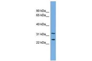 Image no. 1 for anti-Zinc Finger Protein 265 (Zranb2) (AA 143-192) antibody (ABIN6744705) (ZNF265 anticorps  (AA 143-192))