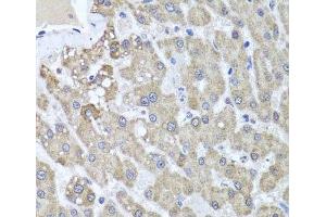 Immunohistochemistry of paraffin-embedded Human liver damage using ALKBH4 Polyclonal Antibody at dilution of 1:100 (40x lens). (ALKBH4 anticorps)
