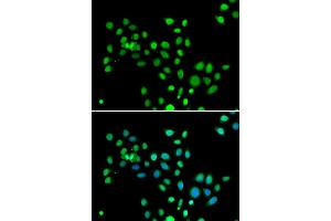 Immunofluorescence analysis of U20S cell using H2AFY antibody. (H2AFY anticorps)