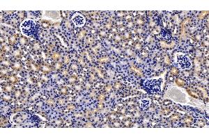 Detection of IDE in Mouse Kidney Tissue using Polyclonal Antibody to Insulin Degrading Enzyme (IDE)