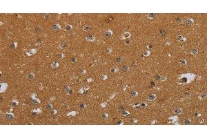 Immunohistochemistry of paraffin-embedded Human brain using CSH1 Polyclonal Antibody at dilution of 1:40