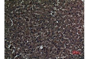 Immunohistochemistry (IHC) analysis of paraffin-embedded Human Liver, antibody was diluted at 1:100.