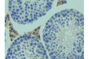 Detection of HMGCS in Mouse Testis Tissue using Polyclonal Antibody to Hydroxymethylglutaryl Coenzyme A Synthase (HMGCS)