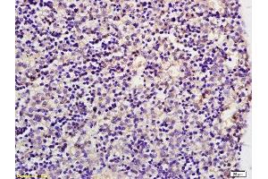 Formalin-fixed and paraffin embedded mouse embryo labeled with Anti GLUT8 Polyclonal Antibody, Unconjugated  at 1:200 followed by conjugation to the secondary antibody and DAB staining