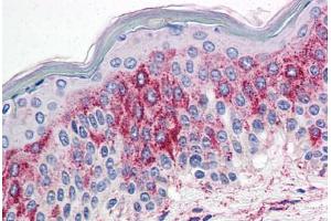Skin, Human: Formalin-Fixed, Paraffin-Embedded (FFPE) (HTR2A anticorps  (N-Term))