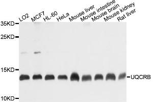 Western blot analysis of extracts of various cell lines, using UQCRB antibody (ABIN4905562) at 1:1000 dilution. (UQCRB anticorps)