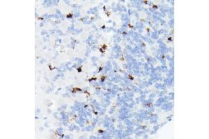 Immunohistochemistry of paraffin-embedded mouse brain using Somatostatin (SST) Rabbit mAb (ABIN7270492) at dilution of 1:1000 (40x lens).