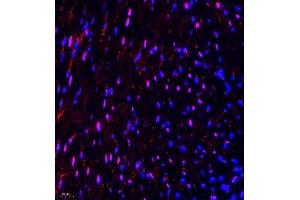 Immunofluorescence of paraffin embedded mouse heart using NSD3 (ABIN7076233) at dilution of 1:650 (400x lens) (WHSC1L1 anticorps)