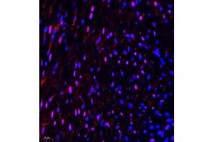 Immunofluorescence of paraffin embedded mouse heart using NSD3 (ABIN7076233) at dilution of 1:650 (400x lens) (WHSC1L1 anticorps)