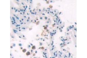 Figure. (HIST1H2AD anticorps  (AA 2-130))