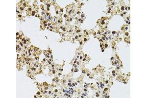 Immunohistochemistry of paraffin-embedded Rat lung using ZNF408 Polyclonal Antibody at dilution of 1:100 (40x lens). (ZNF408 anticorps)