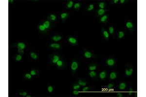 Immunofluorescence of monoclonal antibody to ARL6IP4 on HeLa cell. (ARL6IP4 anticorps  (AA 261-360))