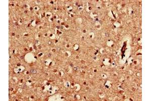 Immunohistochemistry of paraffin-embedded human brain tissue using ABIN7153285 at dilution of 1:100