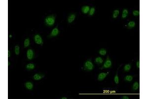 Image no. 3 for anti-Cullin-Associated and Neddylation-Dissociated 1 (CAND1) (AA 1-101) antibody (ABIN599270) (CAND1 anticorps  (AA 1-101))