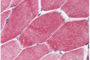 Human Skeletal Muscle (formalin-fixed, paraffin-embedded) stained with PAK2 antibody ABIN214460 at 2. (PAK2 anticorps  (C-Term))