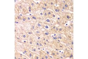 Immunohistochemistry of paraffin-embedded human liver injury using TXN2 antibody. (TXN2 anticorps)