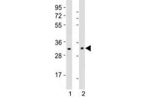 Western blot testing of Nkx2. (NK2 Homeobox 5 anticorps  (AA 98-133))