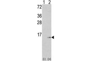 Western blot analysis of S100A6 antibody and 293 cell lysate (2 ug/lane) either nontransfected (Lane 1) or transiently transfected with the S100A6 gene (2). (S100A6 anticorps  (AA 37-67))