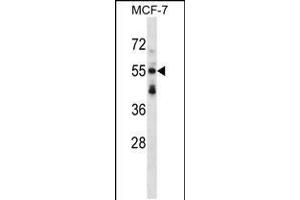 Western blot analysis in MCF-7 cell line lysates (35ug/lane). (SNTB2 anticorps  (AA 217-245))