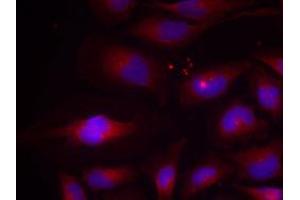 Immunofluorescent staining of methanol-fixed Hela cells using NFKB2 (phospho S870) polyclonal antibody  at 1:100-1:200 dilution. (NFKB2 anticorps  (pSer870))