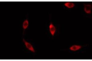 ABIN6267603 staining Hela cells by IF/ICC.
