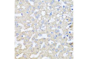 Immunohistochemistry of paraffin-embedded human liver injury using ARL6 antibody at dilution of 1:100 (x40 lens). (ARL6 anticorps)