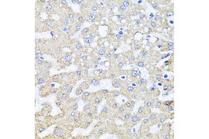 Immunohistochemistry of paraffin-embedded human liver injury using ARL6 antibody at dilution of 1:100 (x40 lens).