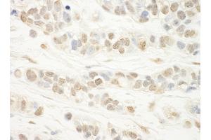 Immunohistochemistry (IHC) image for anti-WD Repeat Domain 5 (WDR5) (AA 50-100) antibody (ABIN7454551)