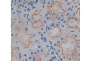 anti-Brain Protein 44-Like (BRP44L) (AA 1-109) antibody