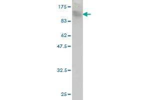 Western Blot detection against Immunogen (120. (TOP3B anticorps  (AA 1-862))