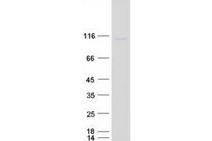 Validation with Western Blot