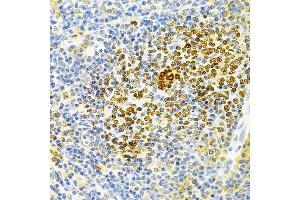Immunohistochemistry of paraffin-embedded rat spleen using TNFRSF11B Antibody (ABIN3022914, ABIN3022915, ABIN3022916 and ABIN6219293) at dilution of 1:200 (40x lens).