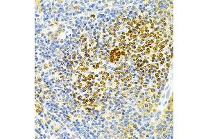 Immunohistochemistry of paraffin-embedded rat spleen using TNFRSF11B Antibody (ABIN3022914, ABIN3022915, ABIN3022916 and ABIN6219293) at dilution of 1:200 (40x lens). (Osteoprotegerin anticorps  (AA 22-280))