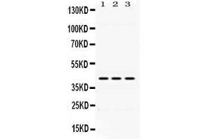 Western blot analysis of DHODH expression in rat liver extract ( Lane 1), mouse spleen extract ( Lane 2) and HEPG2 whole cell lysates ( Lane 3). (DHODH anticorps  (N-Term))