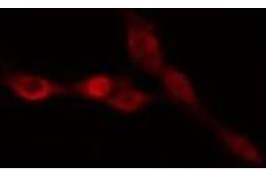 ABIN6274988 staining HepG2 cells by IF/ICC. (CEP170 anticorps  (Internal Region))
