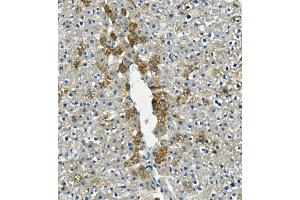 IHC analysis of LIPC using anti-LIPC antibody (ABIN7601582). (LIPC anticorps  (AA 39-494))