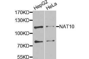 Western blot analysis of extracts of various cells, using NAT10 antibody. (NAT10 anticorps)
