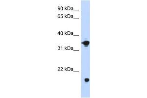 WB Suggested Anti-GPD1 Antibody Titration:  0. (GPD1 anticorps  (Middle Region))