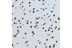 Immunohistochemistry of paraffin-embedded mouse brain using Acetyl-Histone H3-K9 antibody (ABIN7267675) at dilution of 1:200 (40x lens).