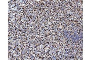 IHC analysis of MFF using anti-MFF antibody (ABIN7599292). (MFF anticorps  (AA 1-342))