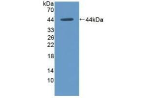 Detection of Recombinant HK1, Rat using Polyclonal Antibody to Hexokinase 1 (HK1)
