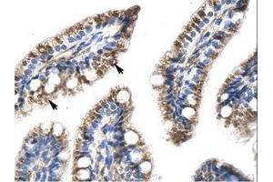 anti-Transcription Factor Dp-1 (TFDP1) (AA 63-112) antibody