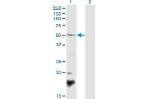Western Blot analysis of BSCL2 expression in transfected 293T cell line by BSCL2 polyclonal antibody (A02). (BSCL2 anticorps  (AA 263-354))