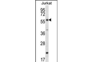 FOXJ3 Antibody (N-term) (ABIN657277 and ABIN2846366) western blot analysis in Jurkat cell line lysates (35 μg/lane). (FOXJ3 anticorps  (N-Term))