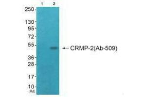 Western blot analysis of extracts from COS7 cells (Lane 2), using CRMP-2 (Ab-509) antiobdy.