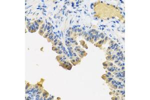 Immunohistochemistry of paraffin-embedded mouse lung using ANGPT1 antibody (ABIN5974767) at dilution of 1/100 (40x lens). (Angiopoietin 1 anticorps)