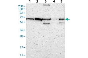 Western blot analysis of Lane 1: RT-4, Lane 2: U-251 MG, Lane 3: Human Plasma, Lane 4: Liver, Lane 5: Tonsil with ME2 polyclonal antibody  at 1:250-1:500 dilution. (NAD-ME anticorps)